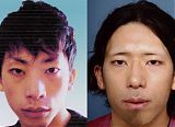 British Woman's Killer Plastic Surgery