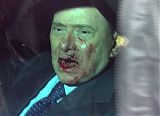 Italian Prime Minister Berlusconi Attacked